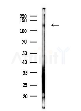 COL19A1 Antibody - Western blot analysis of lysates from EC304 cells(heat-shock,45min treatment), using COL19A1 Antibody at 1/1000 dilution.