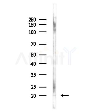 CYB561D1 Antibody - Western blot analysis of lysates from Hela cells(LPS,4h treatment), using CYB561D1 Antibody at 1/1000 dilution.