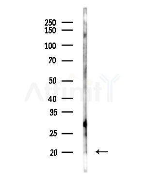 CYB561D1 Antibody - Western blot analysis of lysates from COLO205 cells(heat-shock,45min treatment), using CYB561D1 Antibody at 1/1000 dilution.