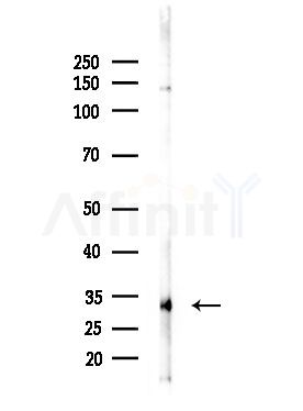 DCL-1 Antibody - Western blot analysis of lysates from MDA-MB-231 cells(heat-shock,45min treatment), using DCL-1 Antibody at 1/1000 dilution.