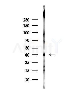 DHHC-9 Antibody - Western blot analysis of lysates from 293 cells(LPS,4h treatment), using DHHC-9 Antibody at 1/1000 dilution.