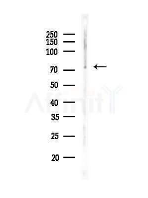 Dynein IC1 Antibody - Western blot analysis of lysates from HUVEC cells, using Dynein IC1 Antibody at 1/1000 dilution.