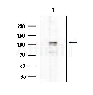 Eg5 Antibody - Western blot analysis of extracts from EC304 cells, using Eg5 Antibody at 1/1000 dilution.