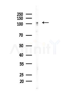 Eg5 Antibody - Western blot analysis of lysates from EC304 cells, using Eg5 Antibody at 1/1000 dilution.