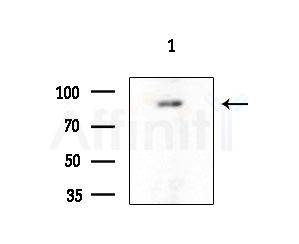 Elongin A1 Antibody - Western blot analysis of extracts from EC304 cells, using Elongin A1 Antibody at 1/1000 dilution.