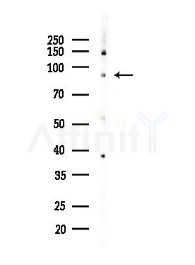 Elongin A1 Antibody - Western blot analysis of lysates from EC304 cells, using Elongin A1 Antibody at 1/1000 dilution.