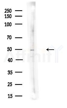 eRF3/GSPT1 Antibody - Western blot analysis of lysates from A375 cells(LPS,4h treatment), using eRF3/GSPT1 Antibody at 1/1000 dilution.
