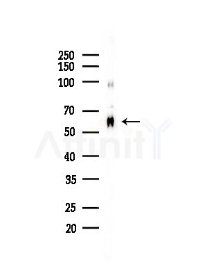 FBP3 Antibody - Western blot analysis of lysates from HepG2 cells(LPS,4h treatment), using FBP3 Antibody at 1/1000 dilution.