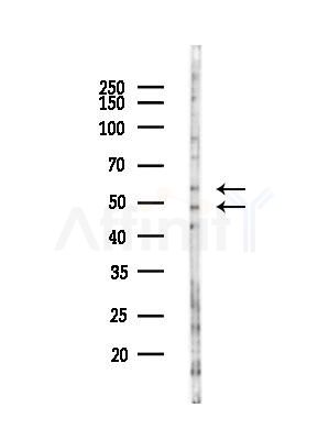 GPRC5C Antibody - Western blot analysis of lysates from Hela cells(heat-shock,45min treatment), using GPRC5C Antibody at 1/1000 dilution.