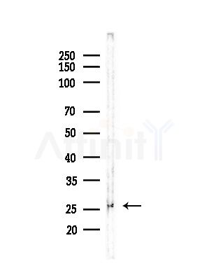Grap Antibody - Western blot analysis of lysates from HepG2 cells(LPS,4h treatment), using Grap Antibody at 1/1000 dilution.