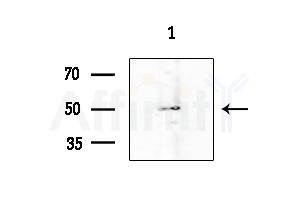 HORMAD1 Antibody - Western blot analysis of extracts from Rat testis, using HORMAD1 Antibody at 1/1000 dilution.
