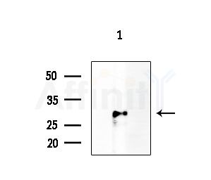 HoxD10 Antibody - Western blot analysis of extracts from EC304 cells, using HoxD10 Antibody at 1/1000 dilution.