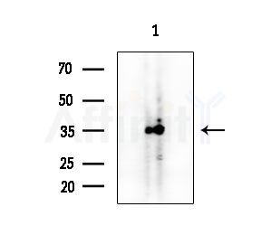 HoxD10 Antibody - Western blot analysis of extracts from HUVEC cells, using HoxD10 Antibody at 1/1000 dilution.