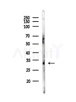 HoxD10 Antibody - Western blot analysis of lysates from HUVEC cells, using HoxD10 Antibody at 1/1000 dilution.