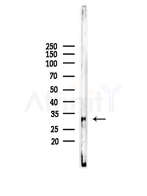 HoxD10 Antibody - Western blot analysis of lysates from EC304 cells, using HoxD10 Antibody at 1/1000 dilution.