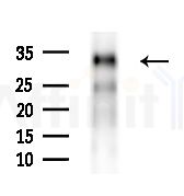 HoxD8 Antibody - Western blot analysis of extracts from HepG2 cells(starvation treatment), using HoxD8 Antibody at 1/1000 dilution.