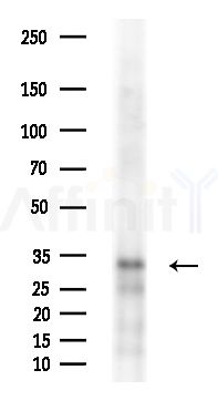 HoxD8 Antibody - Western blot analysis of extracts from EC304 cells(heat-shock treatment), using HoxD8 Antibody at 1/1000 dilution.