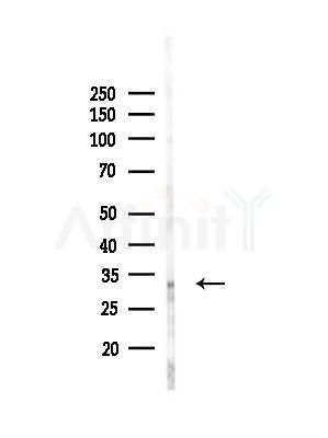 HoxD8 Antibody - Western blot analysis of lysates from EC304 cells(heat-shock,45min treatment), using HoxD8 Antibody at 1/1000 dilution.