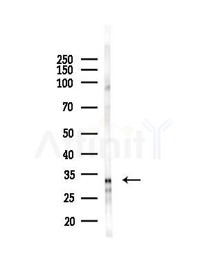 HoxD8 Antibody - Western blot analysis of lysates from HepG2 cells(starvation,24h treatment), using HoxD8 Antibody at 1/1000 dilution.