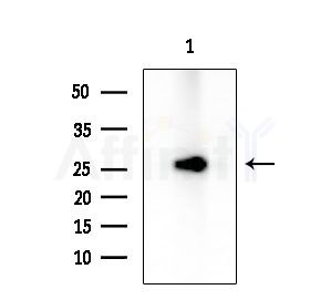 HP1 gamma Antibody - Western blot analysis of extracts from Rat lung, using HP1 gamma Antibody at 1/1000 dilution.