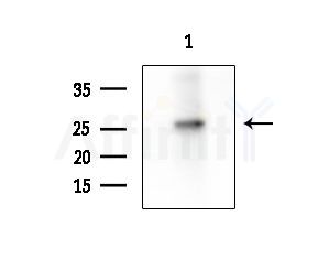 HP1 gamma Antibody - Western blot analysis of extracts from Mouse testis, using HP1 gamma Antibody at 1/1000 dilution.