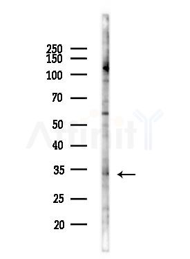 HRT2 Antibody - Western blot analysis of lysates from EC304 cells(heat-shock,45min treatment), using HRT2 Antibody at 1/1000 dilution.