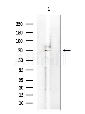 IL-1R9 Antibody - Western blot analysis of extracts from Rat testis, using IL-1R9 Antibody at 1/1000 dilution.