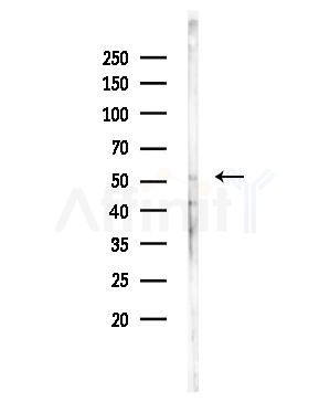 InsP5 2-kinase Antibody - Western blot analysis of lysates from Rat lung, using InsP5 2-kinase Antibody at 1/1000 dilution.