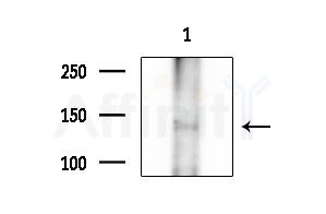 INTS2 Antibody - Western blot analysis of extracts from B16F10-LUC cells(heat-shock treatment), using INTS2 Antibody at 1/1000 dilution.
