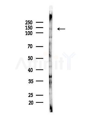INTS2 Antibody - Western blot analysis of lysates from B16F10-LUC cells(heat-shock,45min treatment), using INTS2 Antibody at 1/1000 dilution.
