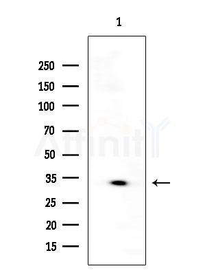 GIRK1/KIR3.1/KCNJ3 Antibody - Western blot analysis of extracts from EC304 cells, using GIRK1/KIR3.