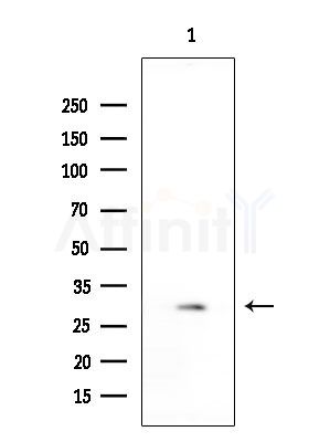 GIRK1/KIR3.1/KCNJ3 Antibody - Western blot analysis of extracts from COLO205 cells, using GIRK1/KIR3.