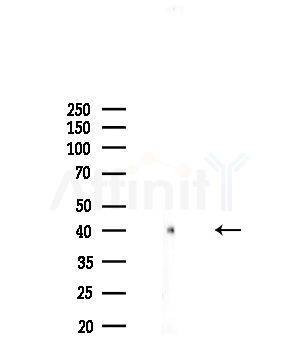 GIRK1/KIR3.1/KCNJ3 Antibody - Western blot analysis of lysates from COLO205 cells, using GIRK1/KIR3.