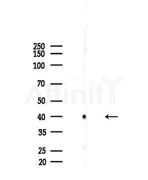 GIRK1/KIR3.1/KCNJ3 Antibody - Western blot analysis of lysates from EC304 cells, using GIRK1/KIR3.
