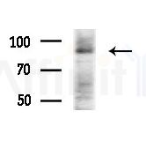 LONP2 Antibody - Western blot analysis of extracts from HepG2 cells(starvation treatment), using LONP2 Antibody at 1/1000 dilution.