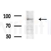 LONP2 Antibody - Western blot analysis of extracts from Mouse testis, using LONP2 Antibody at 1/1000 dilution.