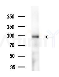 LONP2 Antibody - Western blot analysis of extracts from EC304 cells(heat-shock treatment), using LONP2 Antibody at 1/1000 dilution.