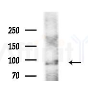 LONP2 Antibody - Western blot analysis of extracts from Rat liver, using LONP2 Antibody at 1/1000 dilution.