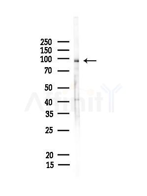 LONP2 Antibody - Western blot analysis of lysates from Rat liver, using LONP2 Antibody at 1/1000 dilution.