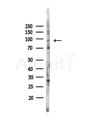 LONP2 Antibody - Western blot analysis of lysates from EC304 cells(heat-shock,45min treatment), using LONP2 Antibody at 1/1000 dilution.