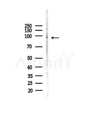 LONP2 Antibody - Western blot analysis of lysates from HepG2 cells(starvation,24h treatment), using LONP2 Antibody at 1/1000 dilution.