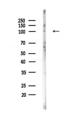 LRP10 Antibody - Western blot analysis of lysates from Hela cells(heat-shock,45min treatment), using LRP10 Antibody at 1/1000 dilution.