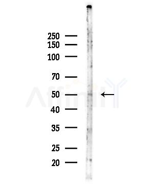 LUC7L2 Antibody - Western blot analysis of lysates from Hela cells(LPS,4h treatment), using LUC7L2 Antibody at 1/1000 dilution.