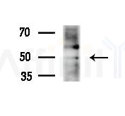 MCT12 Antibody - Western blot analysis of extracts from HepG2 cells(starvation treatment), using MCT12 Antibody at 1/1000 dilution.