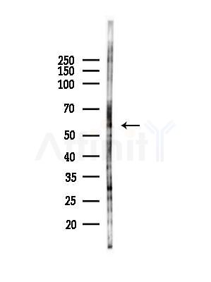 MCT12 Antibody - Western blot analysis of lysates from HepG2 cells(starvation,24h treatment), using MCT12 Antibody at 1/1000 dilution.