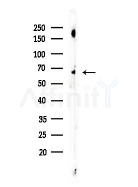ME2 Antibody - Western blot analysis of lysates from Mouse testis, using ME2 Antibody at 1/1000 dilution.