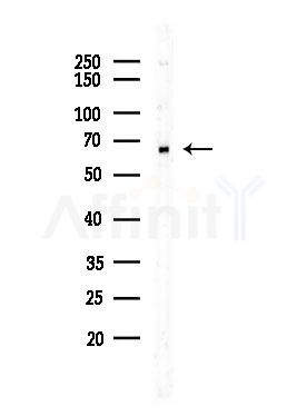 ME2 Antibody - Western blot analysis of lysates from COLO205 cells, using ME2 Antibody at 1/1000 dilution.