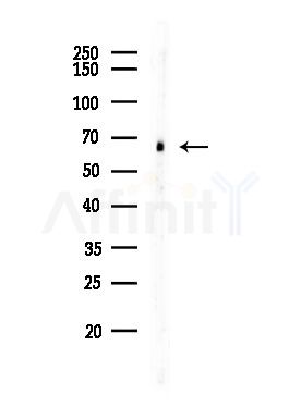 ME2 Antibody - Western blot analysis of lysates from Rat testis, using ME2 Antibody at 1/1000 dilution.
