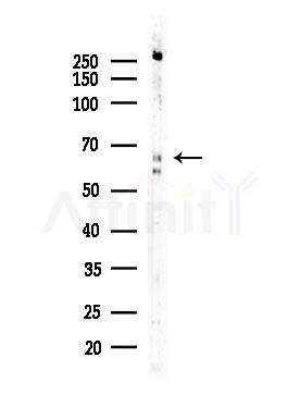 ME2 Antibody - Western blot analysis of lysates from EC304 cells, using ME2 Antibody at 1/1000 dilution.