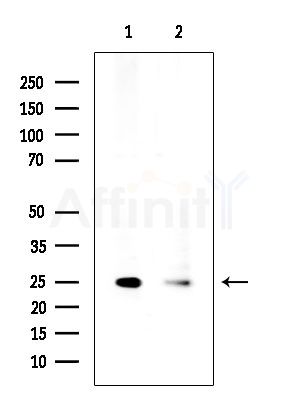 Mob3C Antibody - Western blot analysis of extracts from various samples, using Mob3C Antibody at 1/1000 dilution.